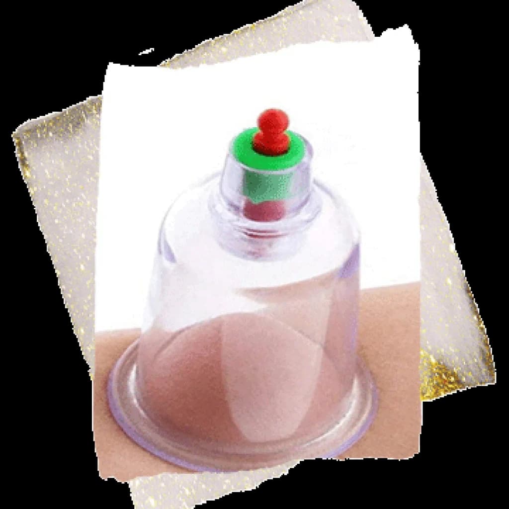 Hijama dry cupping therapy with suction cups at 22 Ayur